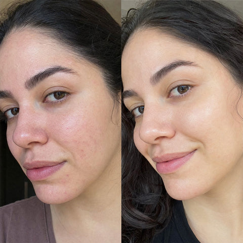 Advanced 5D Pro Light Therapy Face Mask | Best LED Face Mask – NourishMax