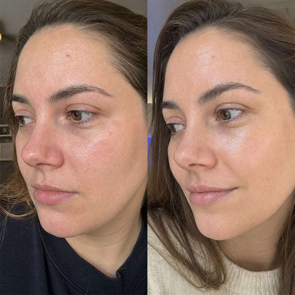 Advanced 5D Pro Light Therapy Face Mask | Best LED Face Mask – NourishMax