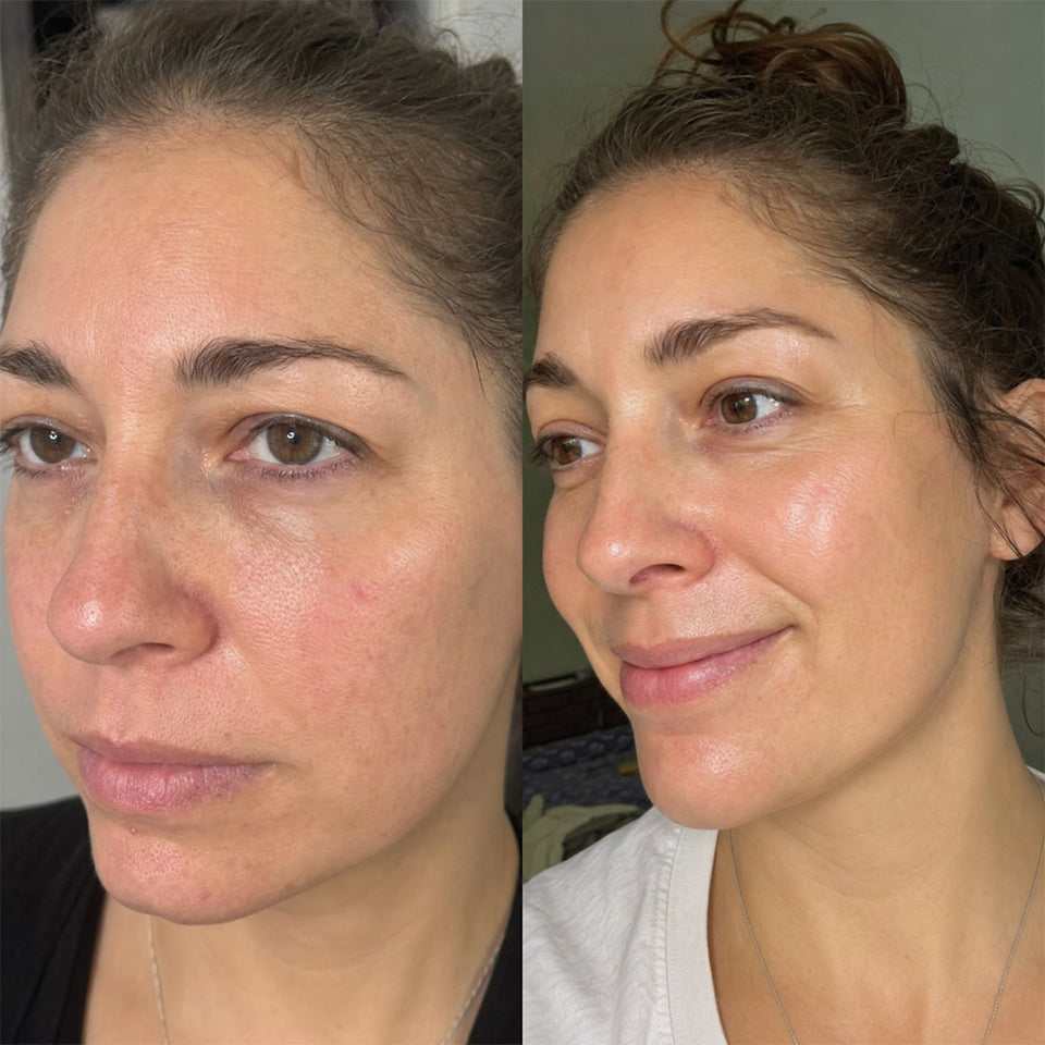 Advanced 5D Pro Light Therapy Face Mask | Best LED Face Mask – NourishMax